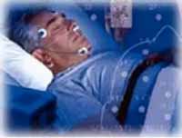 Apneia Obstrutiva do Sono